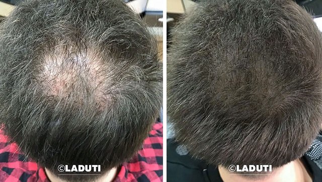 Laduti-Erfahrungen